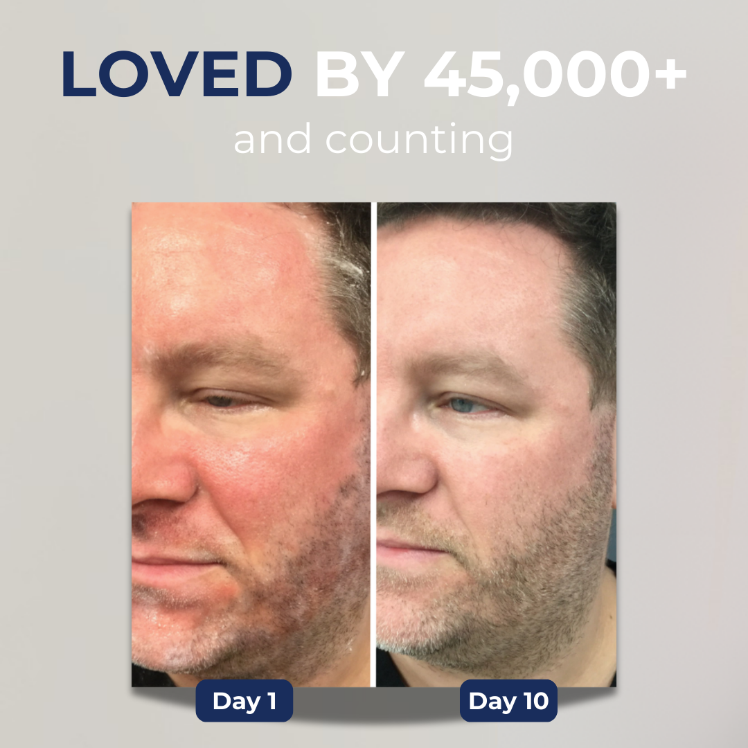 Stronghold Advanced Restore Cream
