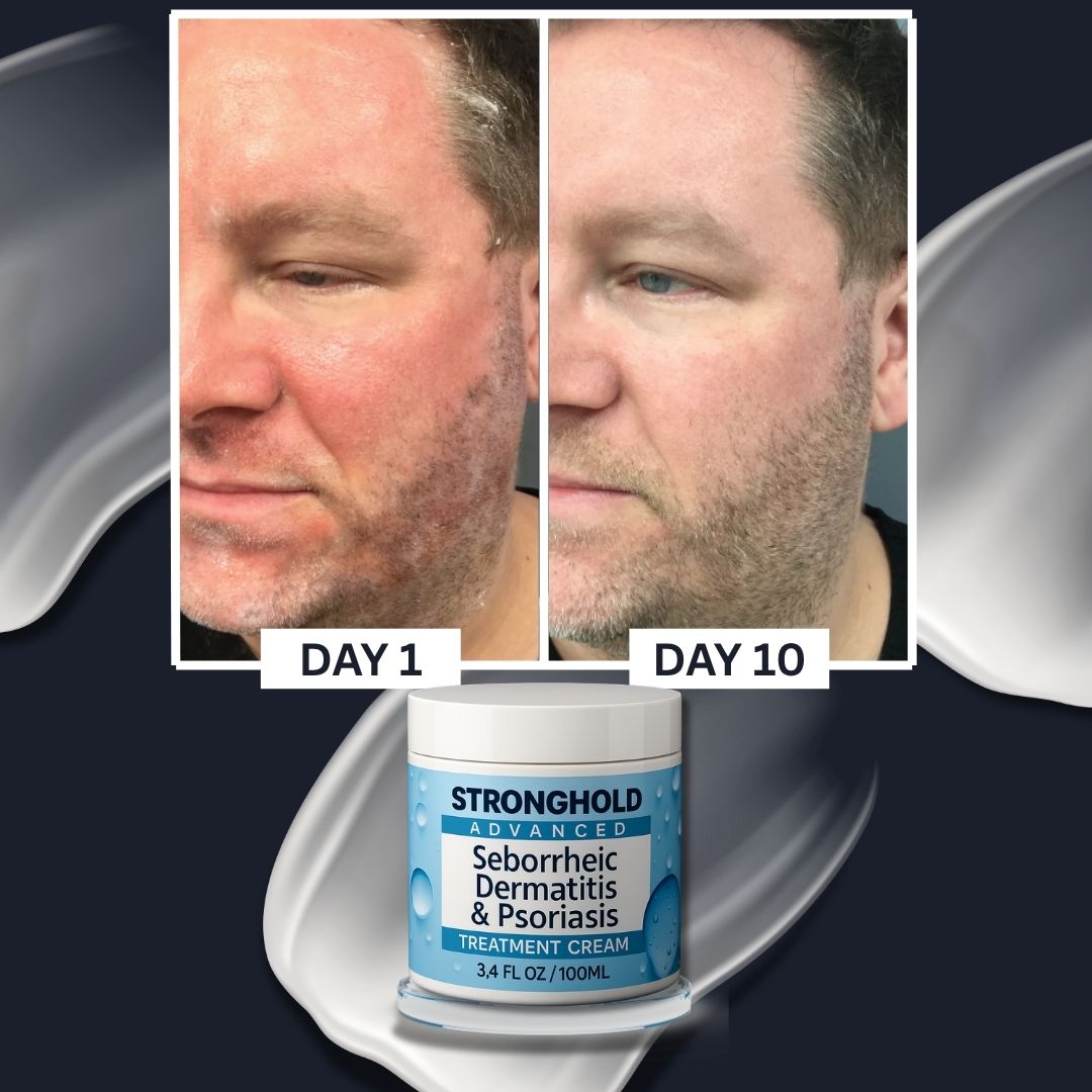 Stronghold Advanced Restore Cream
