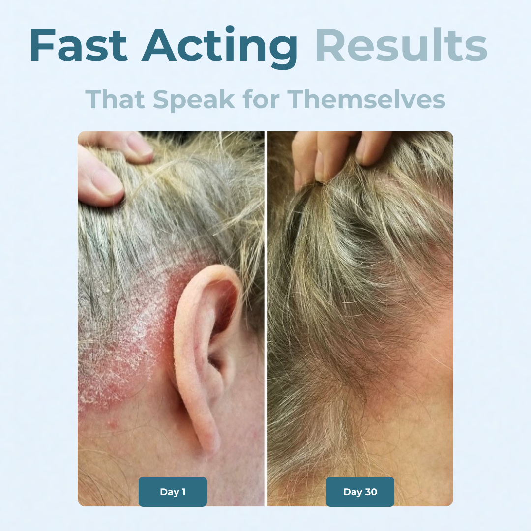 Stronghold Scalp Relief Cream