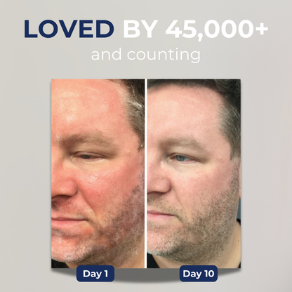 Stronghold Advanced Restore Cream