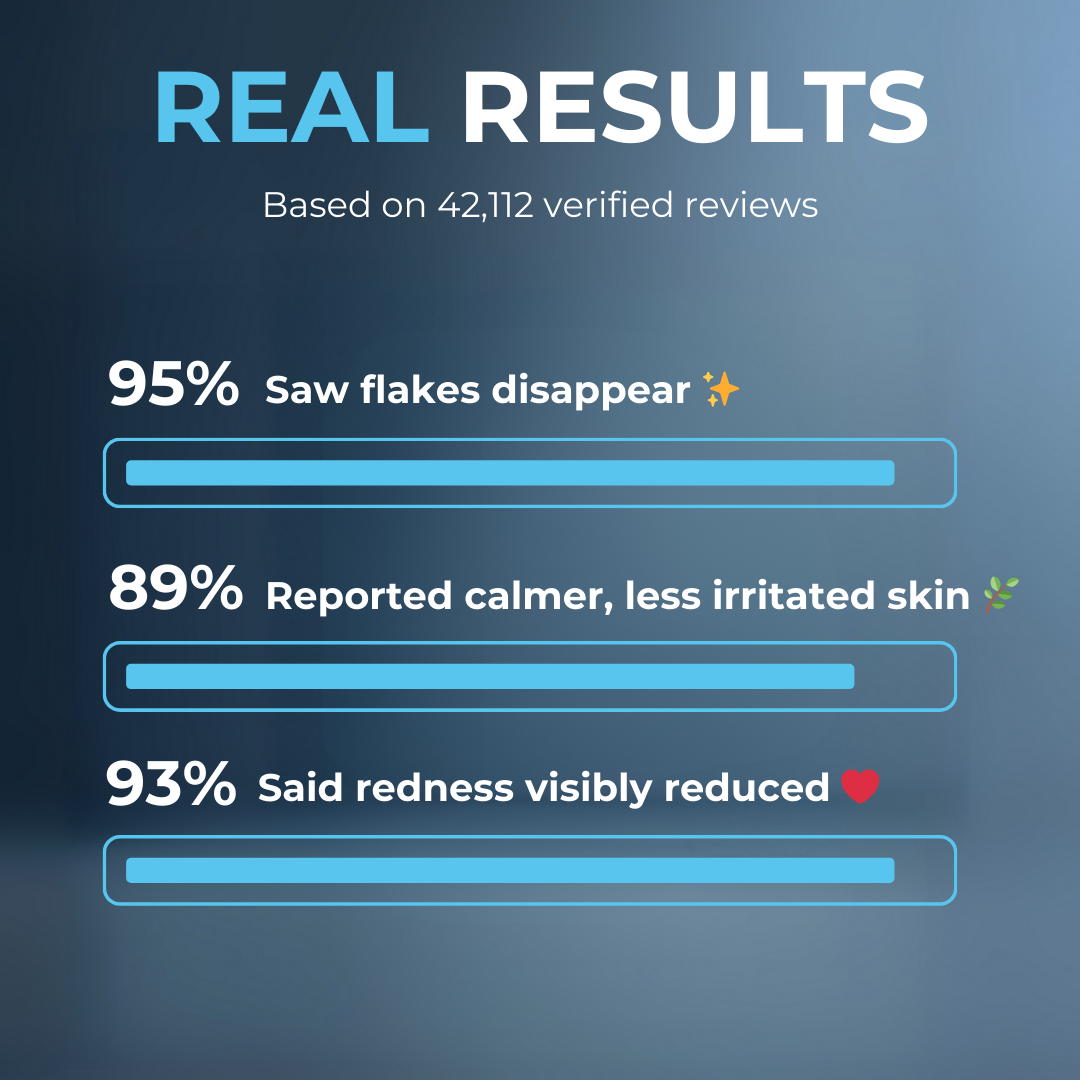 Stronghold Scalp Relief Cream (B)