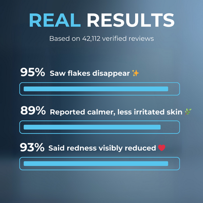 Stronghold Scalp Relief Cream (B)